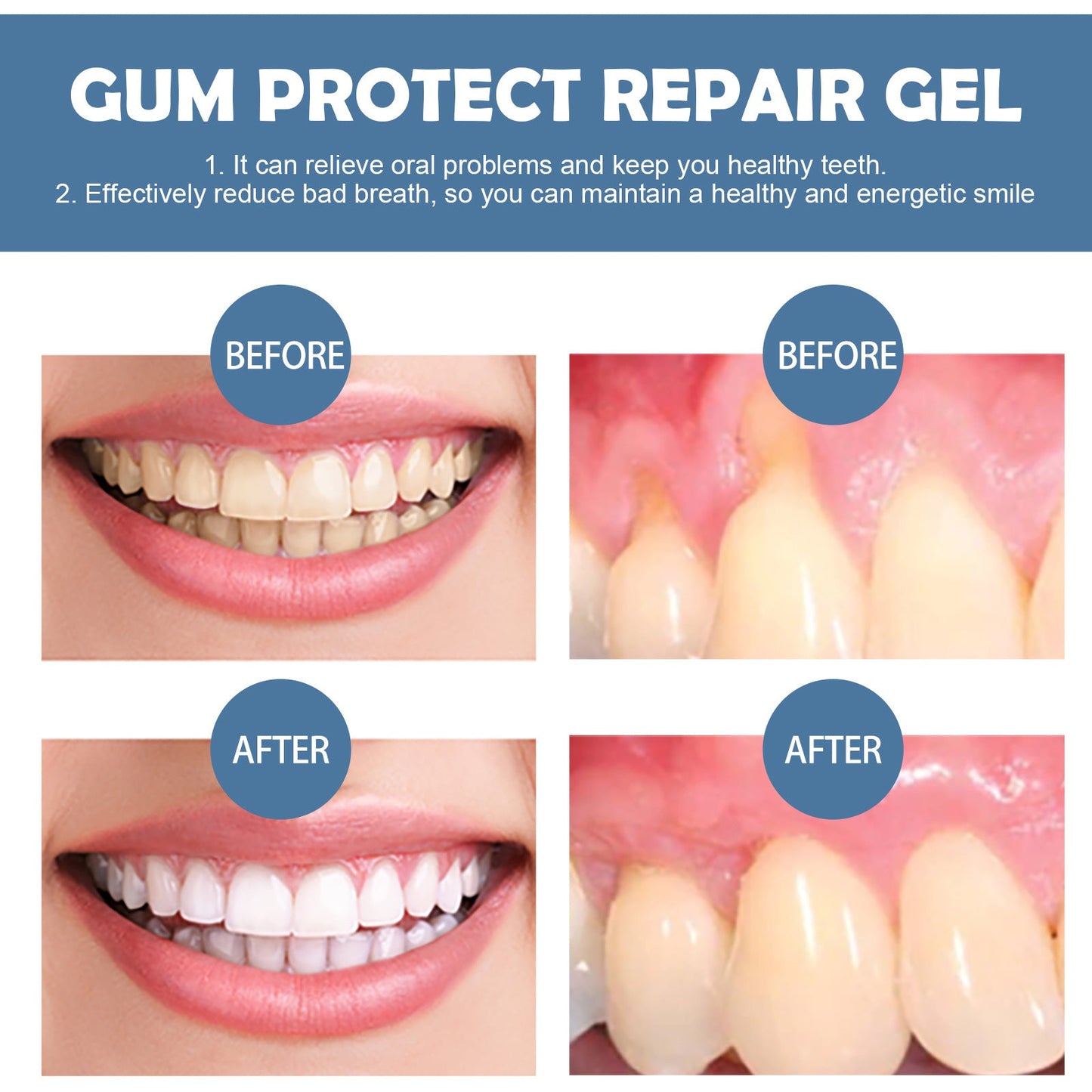 Gum Protect Oral Care Gel – Precision Applicator